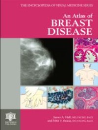 Image of An  Atlas of breast disease